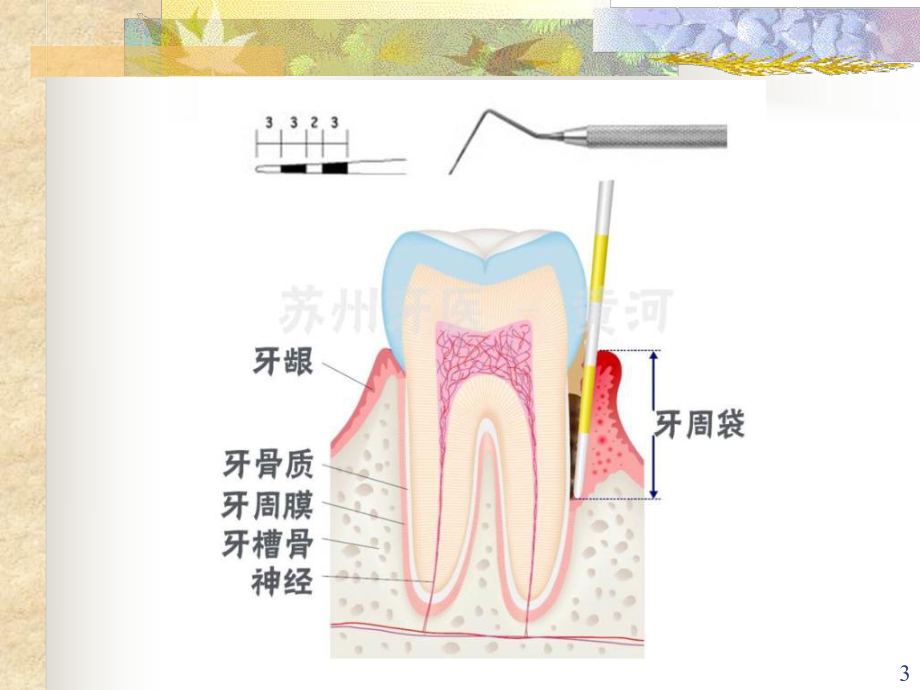 口腔内科学5牙周组织病-课件.ppt_第3页