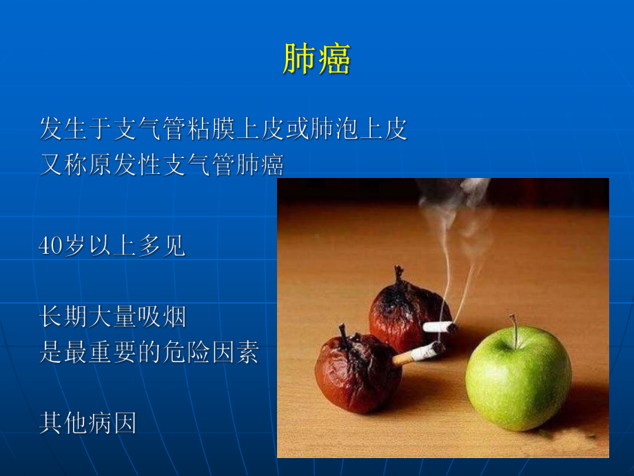 外科学教学-胸部肿瘤课件.ppt_第3页