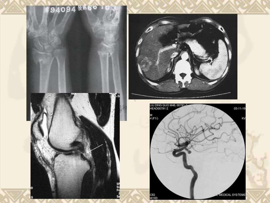 医学影像X线CTMRI-课件.ppt_第2页