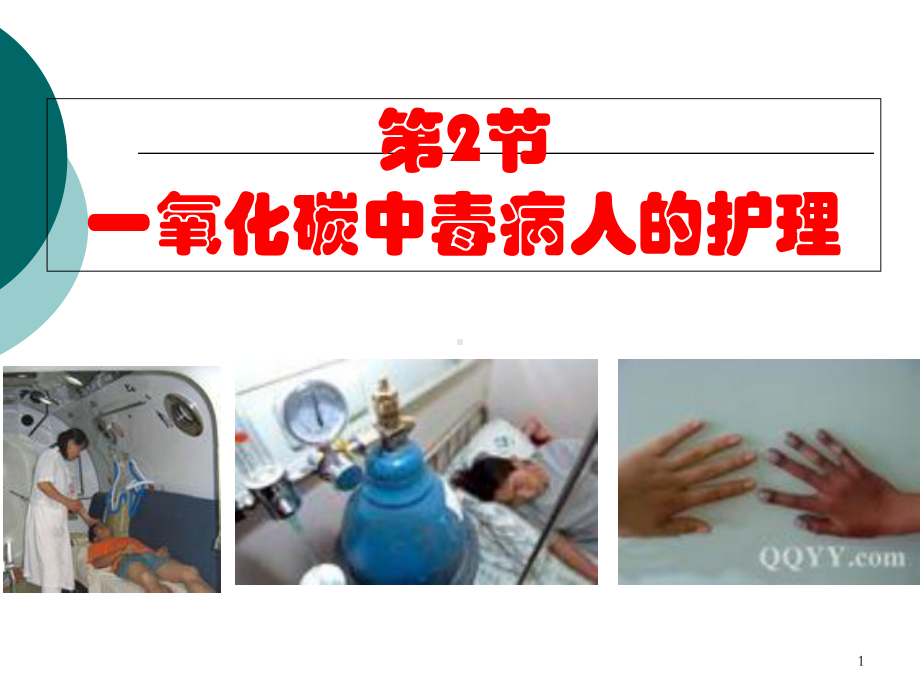 一氧化碳中毒病人的护理课件2.ppt_第1页