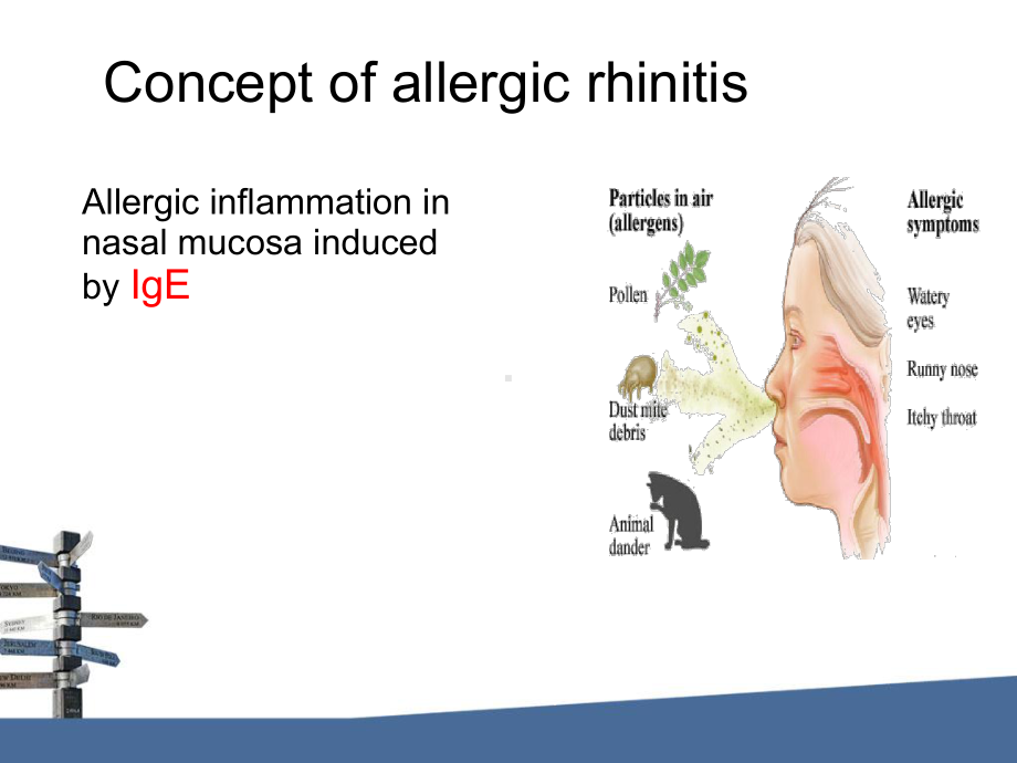 变应性鼻炎(课件).pptx_第3页