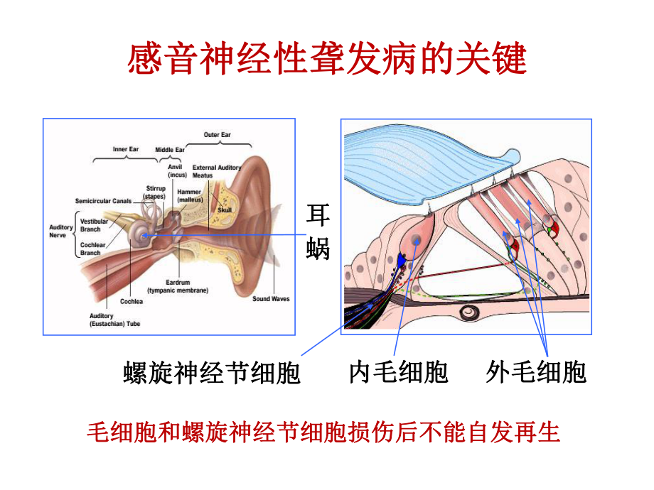 国产人工耳蜗的研制和临床验证现状-课件.ppt_第2页