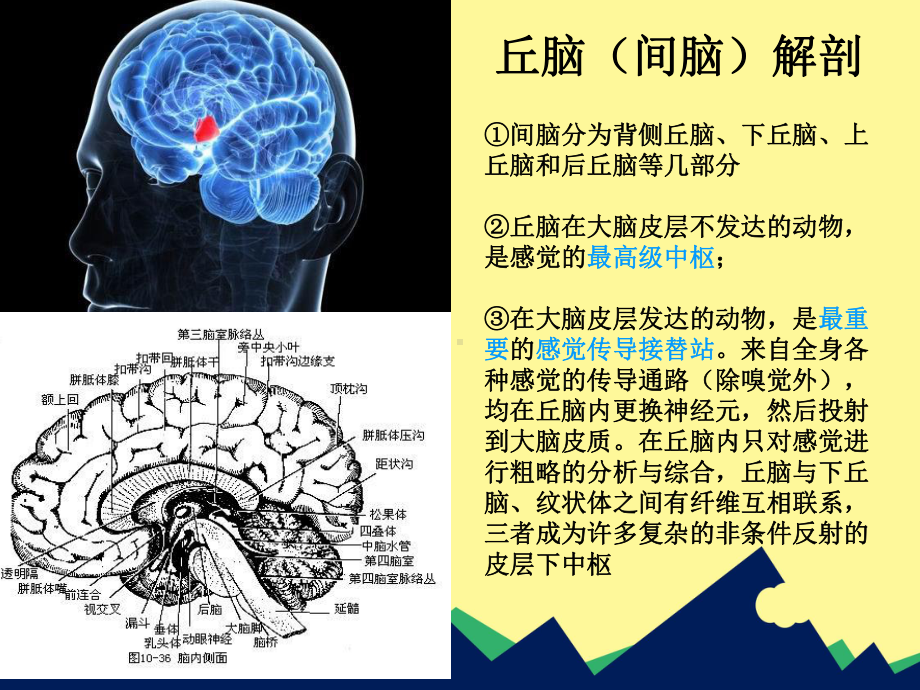 丘脑出血护理课件.ppt_第3页