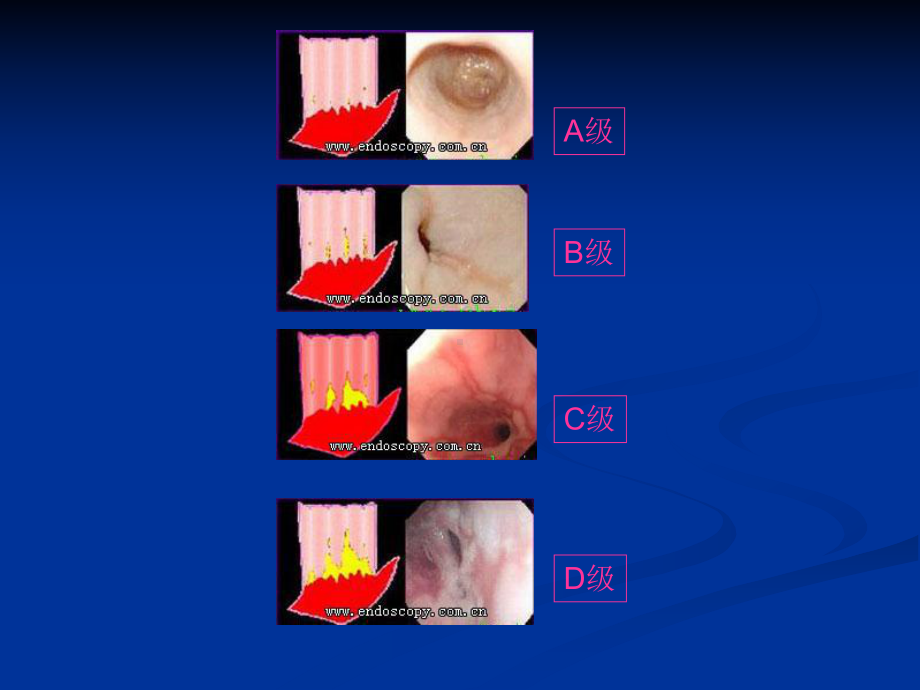上消化道内镜诊断规范课件-2.ppt_第2页