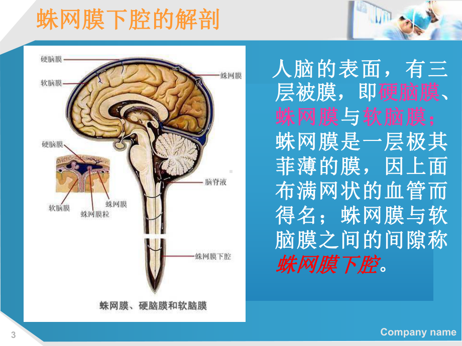 一例蛛网膜下腔出血患者护理查房课件.ppt_第3页