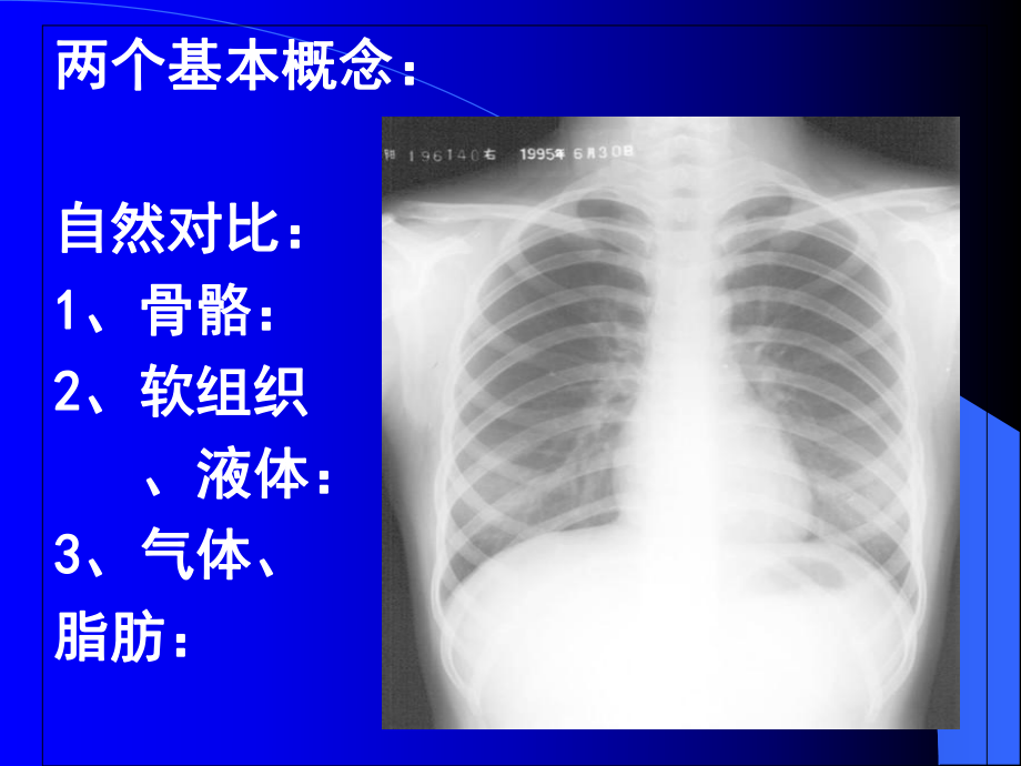 医师资格考试(X线)-影像学课件.ppt_第2页