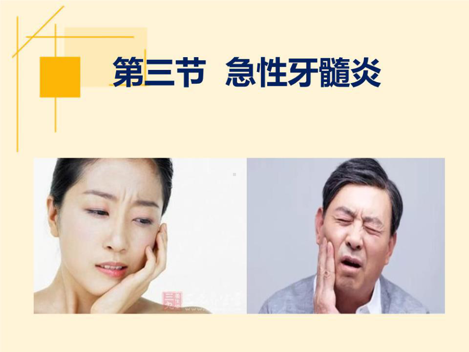 《急性牙髓炎》课件.ppt_第1页