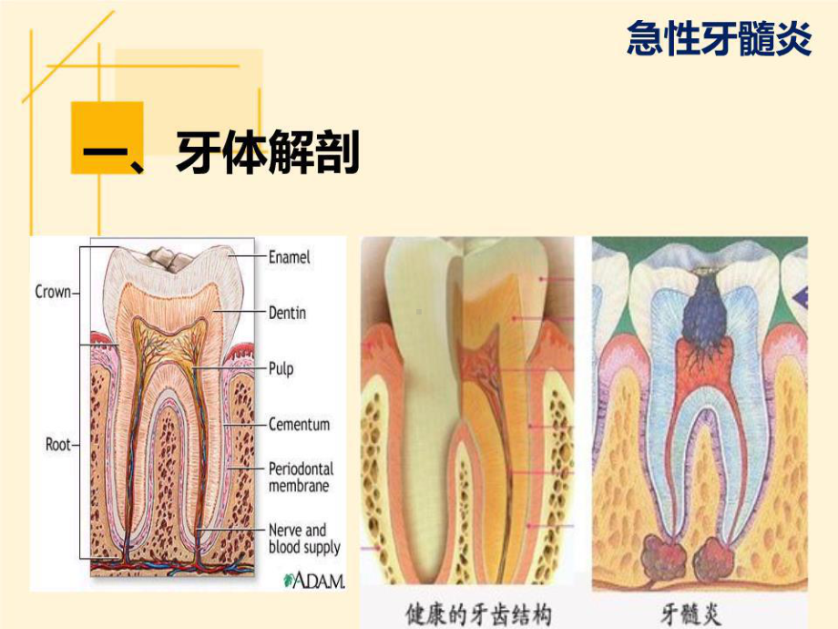 《急性牙髓炎》课件.ppt_第3页