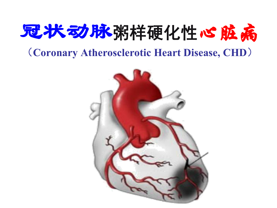 冠状动脉粥样硬化性心脏病解析课件.ppt_第2页