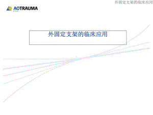 外固定支架的临床应用参考课件.ppt