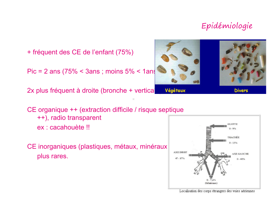 外教医学课件--CE-bronchiques-et-oesophage-支气管和食道.pptx_第3页