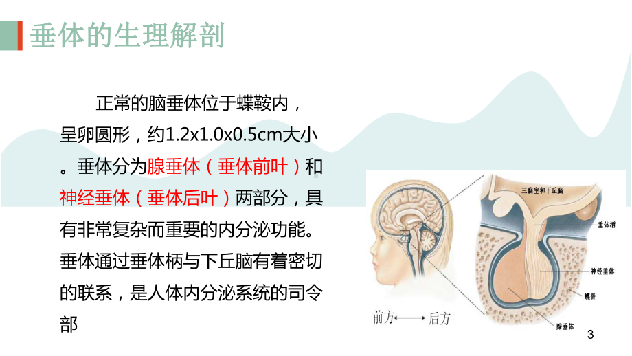 垂体瘤术后护理查房课件.pptx_第3页