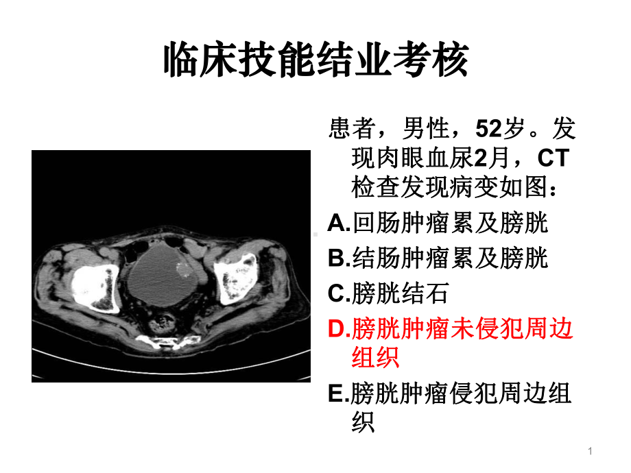 住院医师规陪出科考试辅助检查5概要课件.ppt_第1页