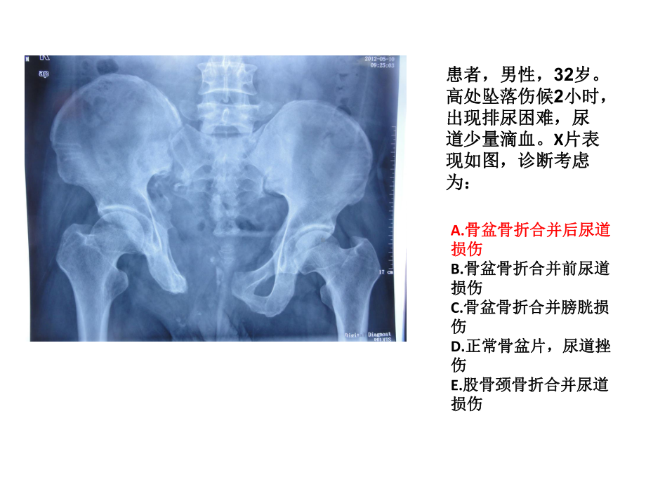 住院医师规陪出科考试辅助检查5概要课件.ppt_第2页