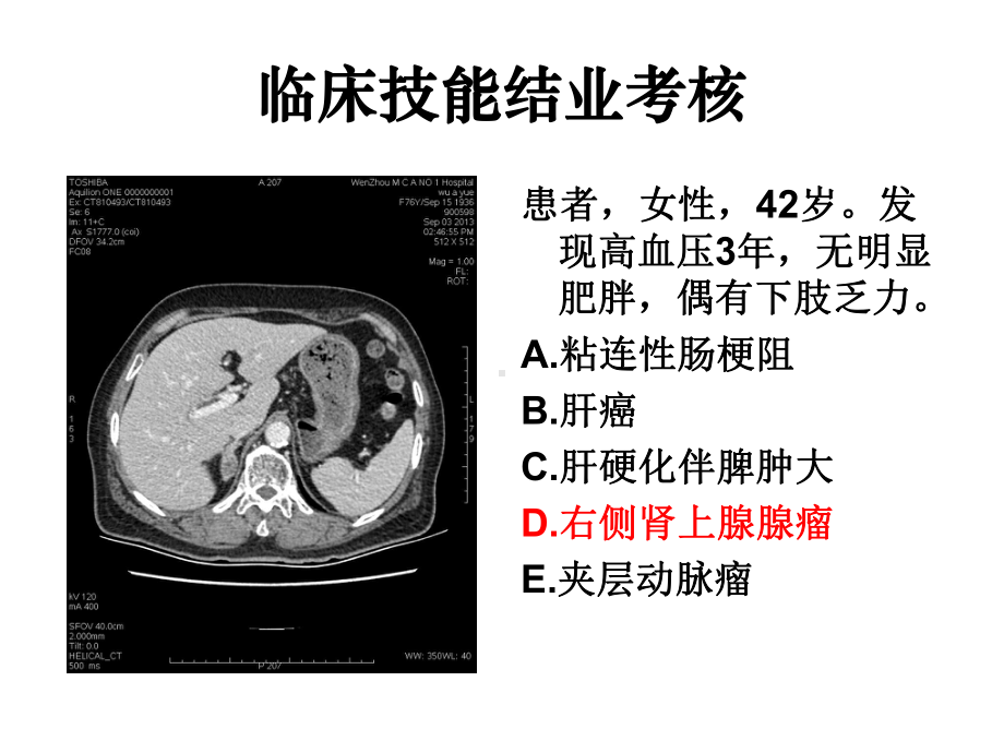 住院医师规陪出科考试辅助检查5概要课件.ppt_第3页