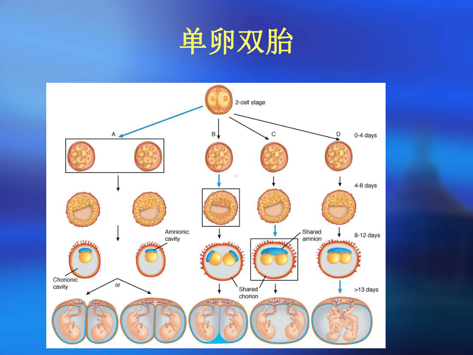 多胎妊娠-妇产科学课件.ppt_第3页