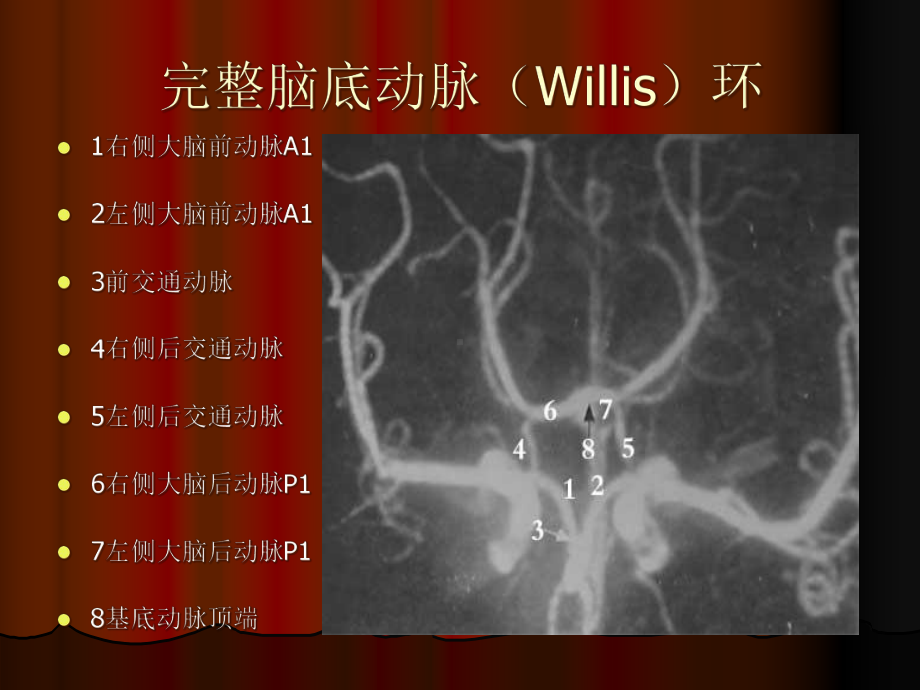 大脑前动脉动脉瘤-用教学课件.ppt_第3页