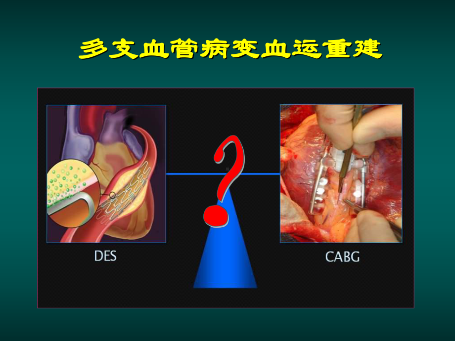 冠心病介入治疗再认识-课件.ppt_第2页