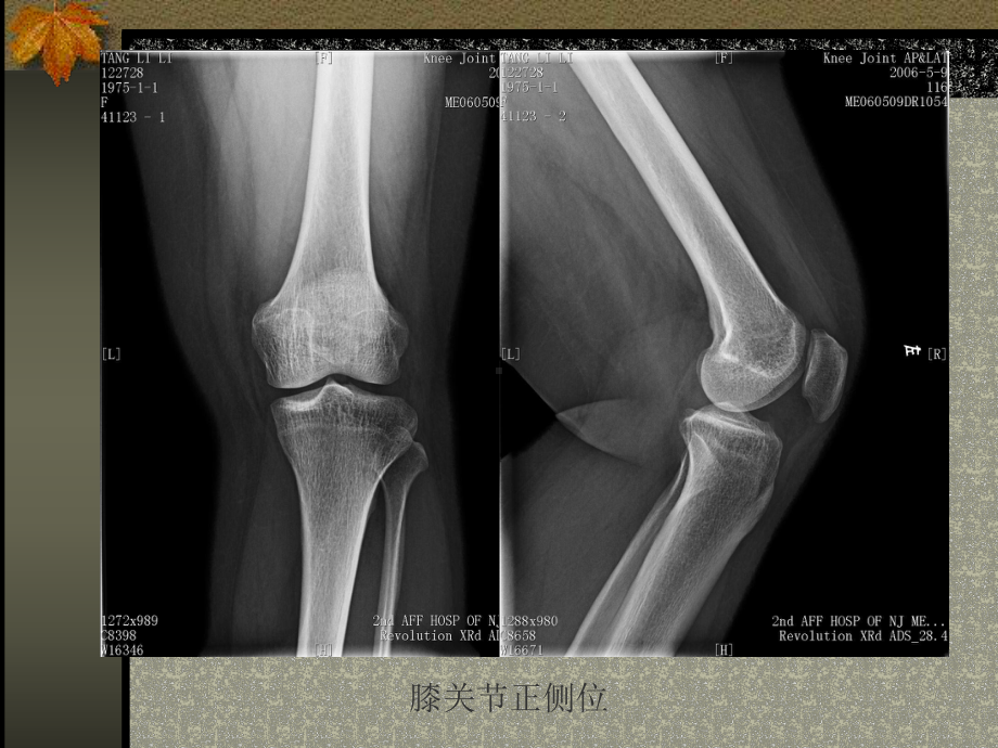 医学影像学：肌、骨与关节系统课件.ppt_第2页