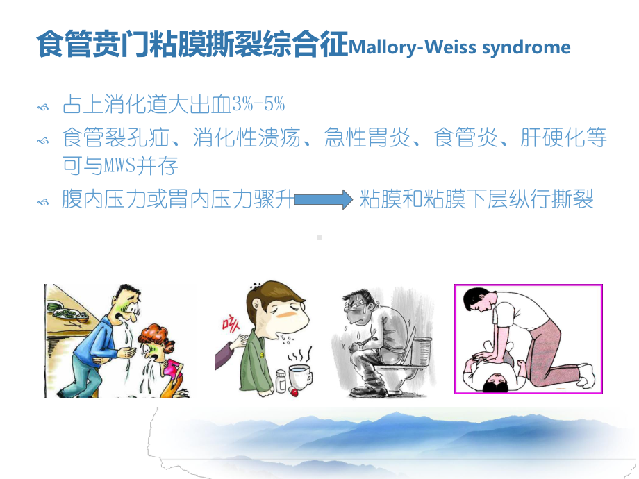 上消化道出血少见病因课件.ppt_第2页