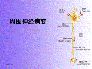 周围神经病变-sx课件.ppt