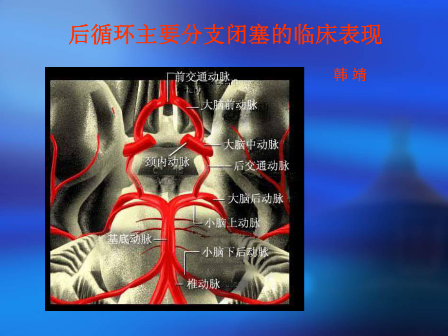 后循环主要分支闭塞的临床表现课件.ppt_第1页