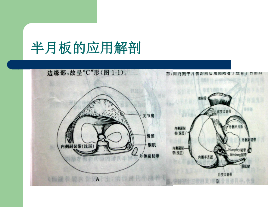 半月板的解剖和功能课件.ppt_第3页