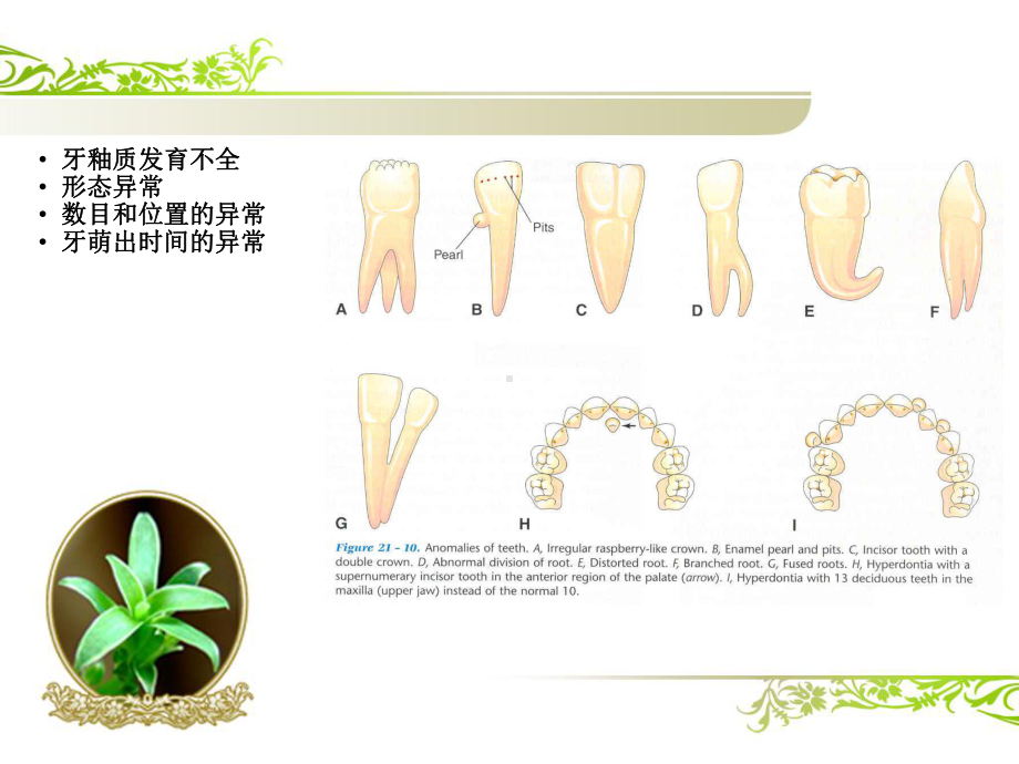 口腔组织病理学课件：牙的发育.ppt_第3页