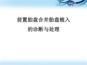 前置胎盘合并胎盘植入的诊断与处理医学课件.pptx