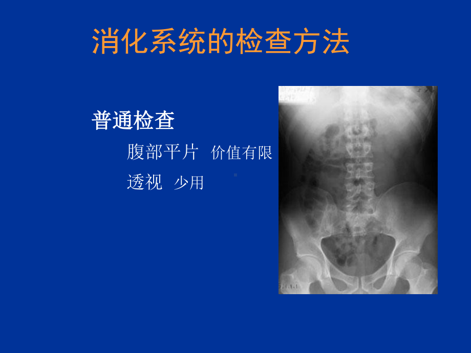 医学影像诊断详解完整版-消化系统影像诊断-课件.ppt_第2页