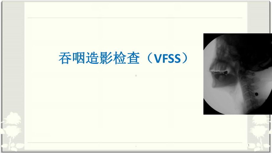 吞咽造影检查(VFSS)医学课件.pptx_第1页