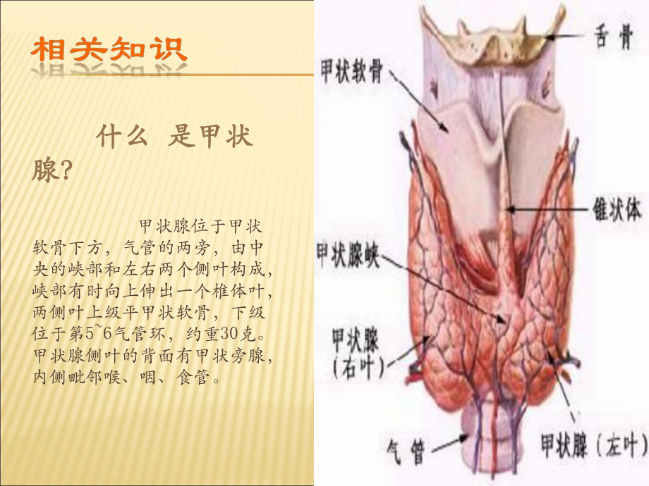 培训-甲状腺肿护理查房课件.ppt_第3页