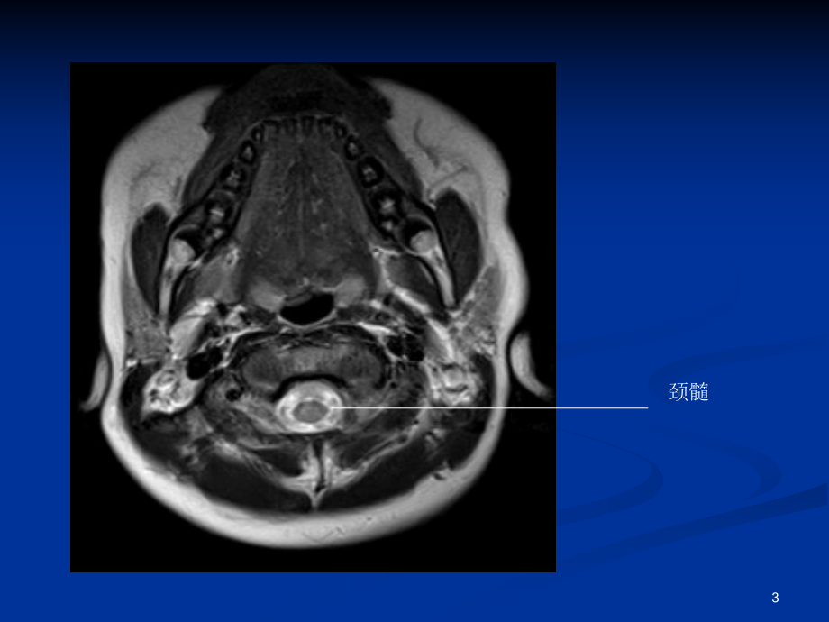 头颅CT与MRI的正常图像医学课件.ppt_第3页