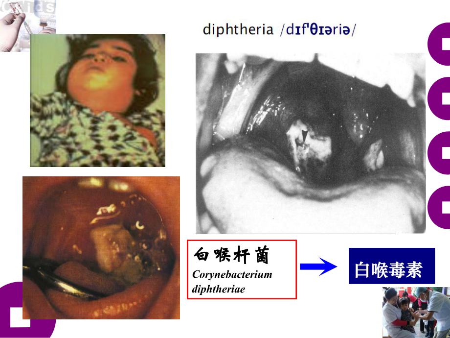 免疫球蛋白课件-2.ppt_第3页