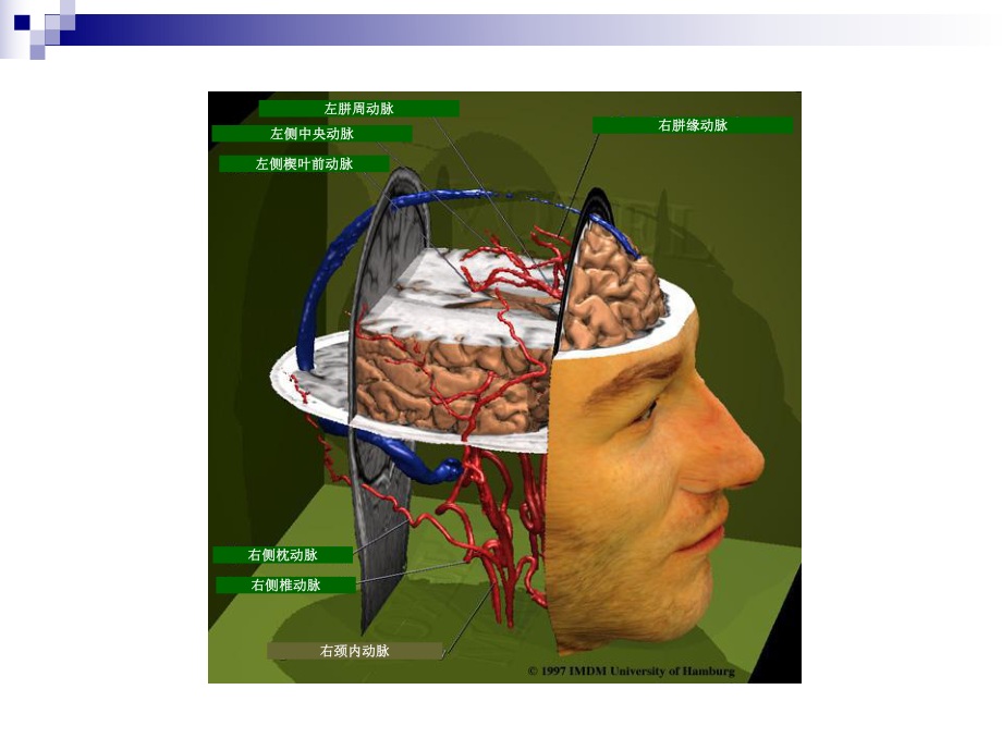 人脑和脑血管解剖分析课件.ppt_第2页