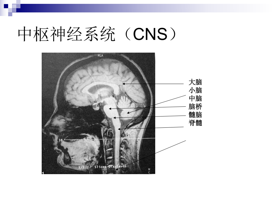 人脑和脑血管解剖分析课件.ppt_第3页