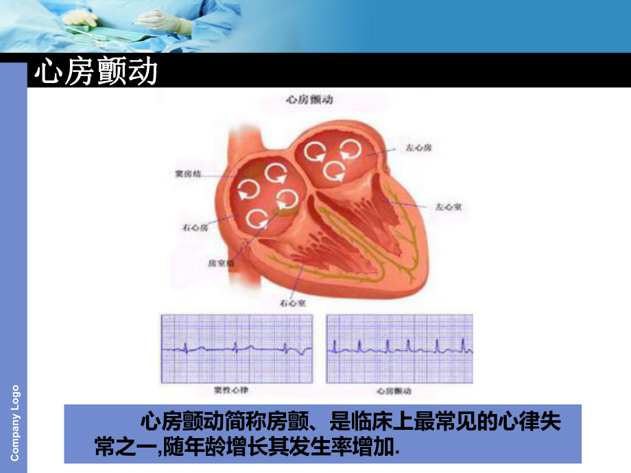 医院培训房颤临床表现及护理措施课件.pptx_第3页