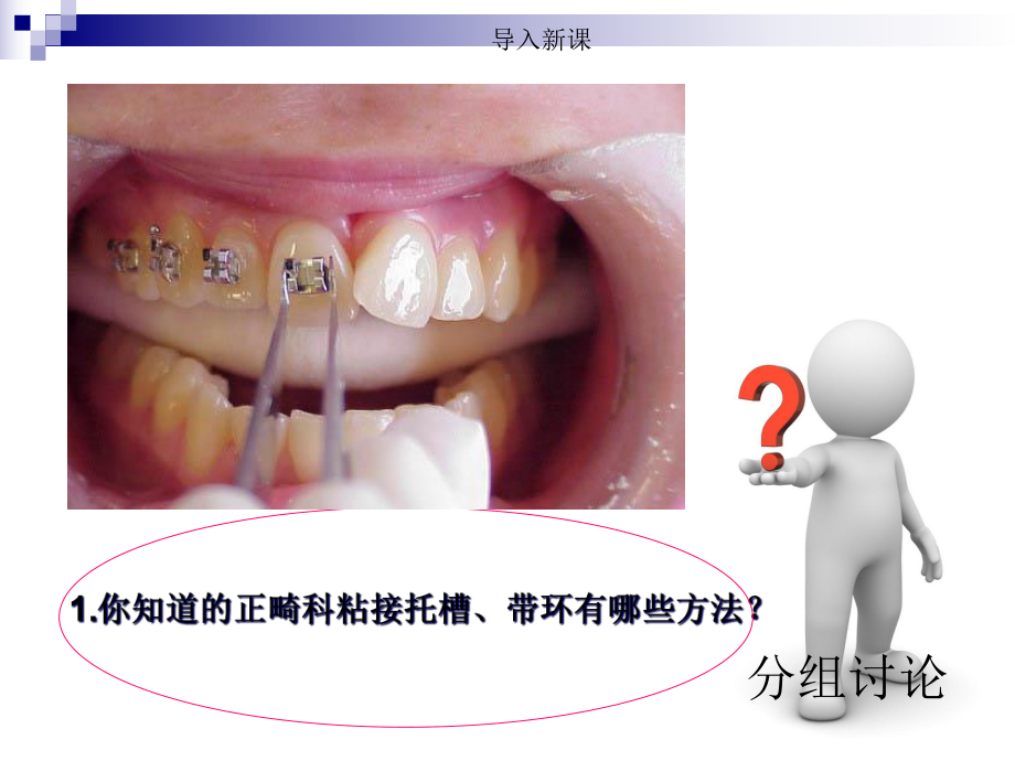 口腔正畸病人护理第三章-第三节-正畸粘结技术课件.ppt_第3页