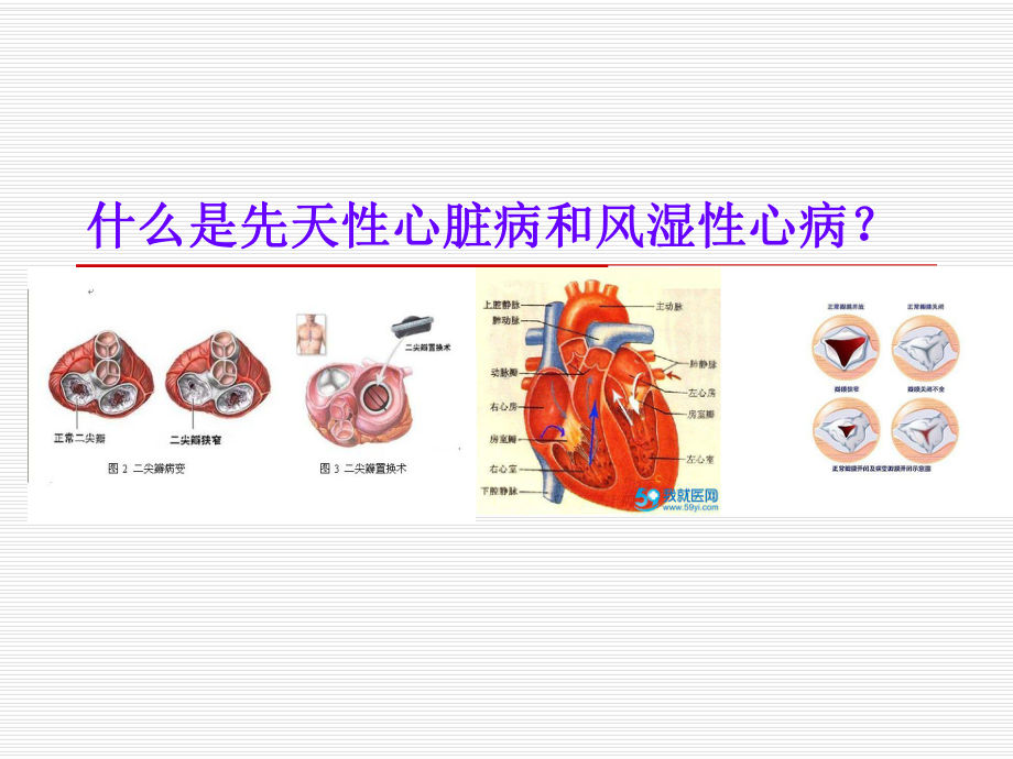 先天性心脏及风湿性心脏病（生物作业）课件.ppt_第1页