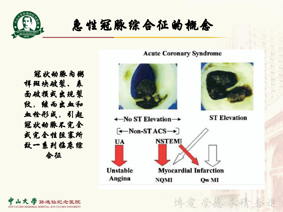 冠心病合并急性心律失常的紧急处理49张课件.ppt_第1页