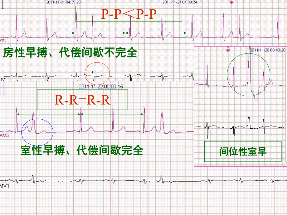 《心电图讲课》课件.ppt_第3页