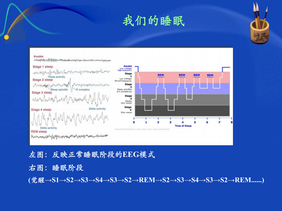 卒中后睡眠障碍医学课件.pptx_第2页