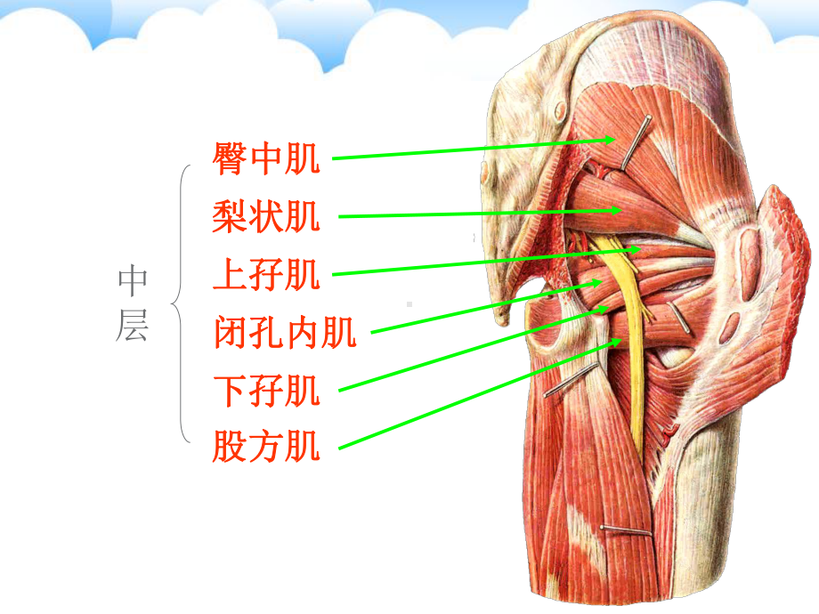 （管理）梨状肌综合征汇编课件.ppt_第2页