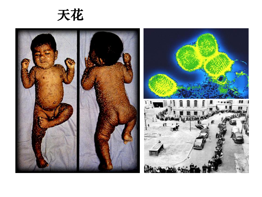 传染病学总论课件-2.ppt_第2页