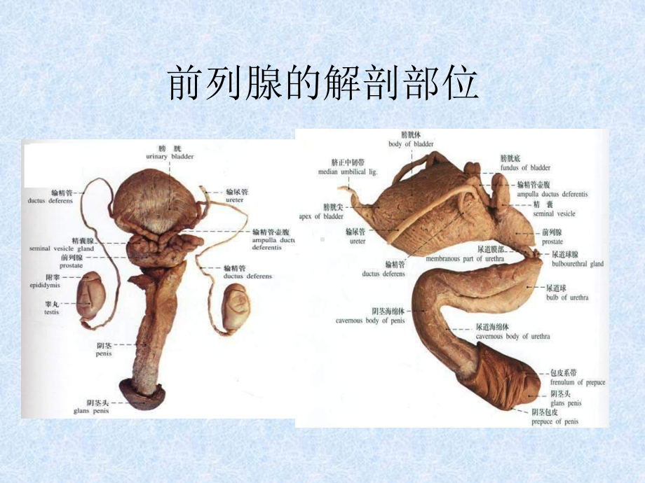 前列腺增生症课件-2.ppt_第3页