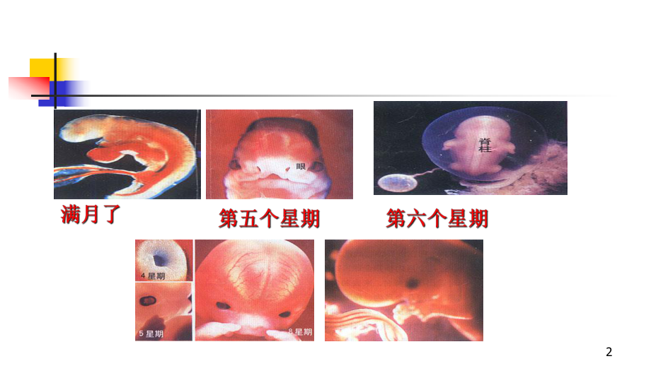 先天性心脏病医学课件.ppt_第2页