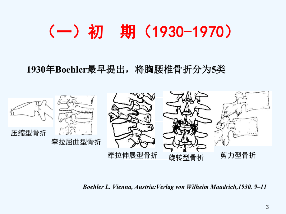 胸腰椎骨折研究与发展课件.ppt_第3页