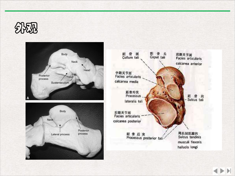 距骨骨折的诊断与治疗策略实用版课件.ppt_第3页