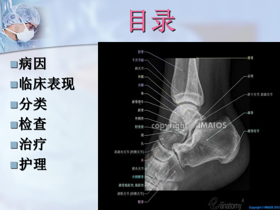 踝骨骨折课件.pptx_第2页