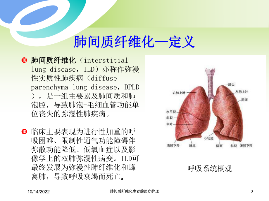 肺间质纤维化患者的医疗护理培训课件.ppt_第3页